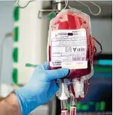  ?? FOTO: DPA/PA ?? Mit kaum blutenden Operations­techniken könnten Blutkonser­ven gespart werden.