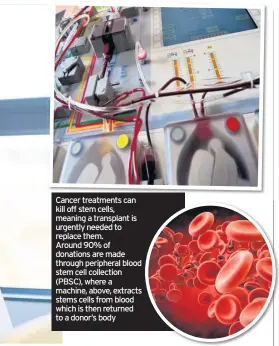  ??  ?? Cancer treatments can kill off stem cells, meaning a transplant is urgently needed to replace them. Around 90% of donations are made through peripheral blood stem cell collection (PBSC), where a machine, above, extracts stems cells from blood which is then returned to a donor’s body