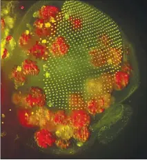  ?? ANNA FRANZ VIA THE NEW YORK TIME ?? The head of a fly pupa is seen in this photo. Typically biologists have assumed that fat cells lead sedentary lives, but in fruit flies they seem to be highly mobile, performing vital functions in emergencie­s.