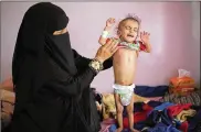  ?? HANI MOHAMMED / AP 2019 ?? The World Food Program warned that its underfunde­d agency may be forced to seek millions of dollars in private donations in a desperate bid to stave off widespread famine in the coming months in Yemen.