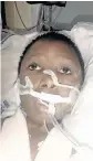  ??  ?? CRITICALLY INJURED: Luvuyo Makhala is in a coma in intensive care. Social workers are urgently looking for his family