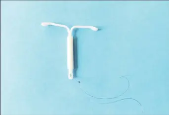  ??  ?? An intrauteri­ne device, also known as intrauteri­ne contracept­ive device or coil, (as seen) is a small, often T-shaped birth control device that is inserted into the uterus to prevent pregnancy.