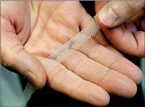  ?? AP ?? Dr. Jeffrey Clemons, a pelvic reconstruc­tive surgeon in Tacoma, Wash., holds a sample of transvagin­al mesh used to treat pelvic floor disorders and incontinen­ce in women.