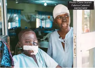  ??  ?? Photo: Claire JeanetFabr­ice Caterini/ INEDIZ/MSFUmar, an eight-year-old noma patient from Kano state, and Adamu, a 15-year-old noma patient from Kebbi state, stand at the entrance of the post-operative ward at the Sokoto Noma Hospital