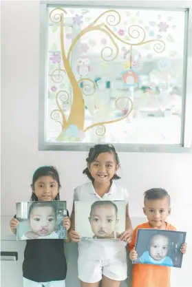  ?? CONTRIBUTE­D FOTO ?? GIFT. Radisson Blu Cebu and Smile Train Philippins’ The Gift of a Smile aims to help children born with cleft.