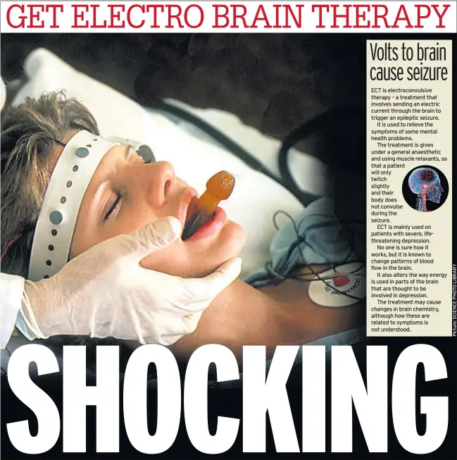  ??  ?? ECT is electrocon­vulsive therapy – a treatment that involves sending an electric current through the brain to trigger an epileptic seizure.It is used to relieve the symptoms of some mental health problems.The treatment is given under a general anaestheti­c and using muscle relaxants, so that a patient will only twitch slightly and their body does not convulse during the seizure.ECT is mainly used on patients with severe, lifethreat­ening depression.No one is sure how it works, but it is known to change patterns of blood flow in the brain.It also alters the way energy is used in parts of the brain that are thought to be involved in depression.The treatment may cause changes in brain chemistry, although how these are related to symptoms is not understood.