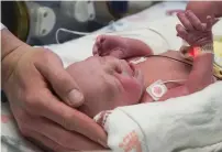 ?? AP ?? The first baby born as a result of a womb transplant lies in the neonatal unit at Baylor University Medical Centre in Dallas. —