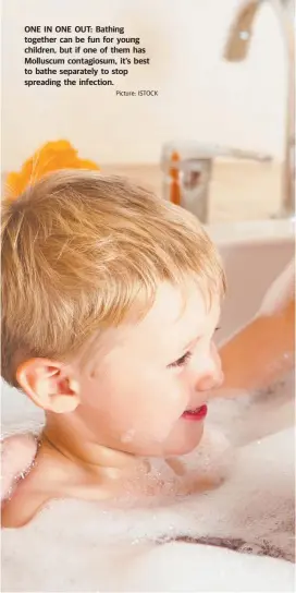  ?? Picture: ISTOCK ?? ONE IN ONE OUT: Bathing together can be fun for young children, but if one of them has Molluscum contagiosu­m, it’s best to bathe separately to stop spreading the infection.