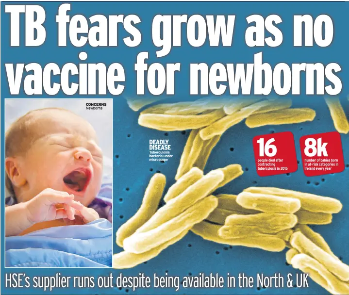  ??  ?? CONCERNS Newborns DEADLY DISEASE Tuberculos­is bacteria under microscope