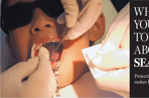  ?? JOURNAL FILE ?? A young patient receives a dental sealant, which helps ward off cavities.