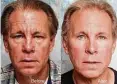  ?? Photo courtesy of lidlift.com ?? This patient received Botox injections and fillers.