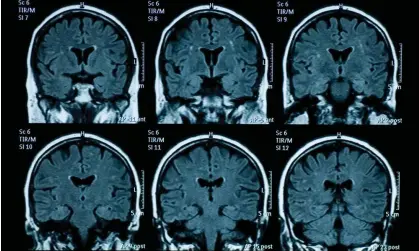  ?? ?? Brain age difference was about three years, the researcher­s found. Photograph: Getty Images