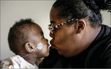  ?? AP ?? Curtis Means kisses his mother, Michelle Butler at their home in Eutaw, Ala., on March 23. Butler was just over halfway through her pregnancy when she discovered that her twins were coming much too soon.