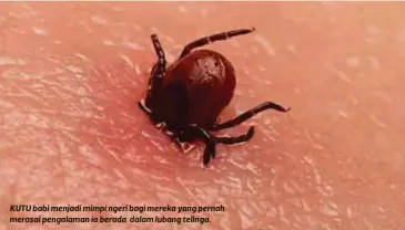  ?? ?? KUTU babi menjadi mimpi ngeri bagi mereka yang pernah merasai pengalaman ia berada dalam lubang telinga.