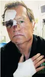  ??  ?? Former Roughrider Alan Ford, 70, was attacked
Monday.