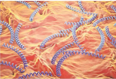 ??  ?? Syphilis wird durch ein Bakterium ausgelöst. Charakteri­stisch für Treponema pallidum ist die korkenzieh­erähnliche Struktur.
