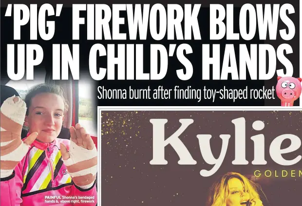  ??  ?? PAINFUL Shonna’s bandaged hands &amp;, above right, firework