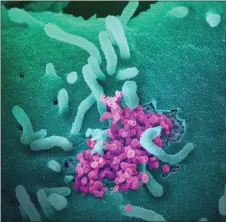  ??  ?? The National Institutes of Health (NIH)/NIAD-RML shows a scanning electron microscope image of SARS-CoV-2 (round magenta objects) emerging from the surface of cells cultured in the lab, SARS-CoV-2, also known as 2019-nCoV, is the virus that causes Covid-19. The virus shown was isolated from a patient in the US.