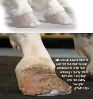  ??  ?? DISTORTED: Severe cases of club foot can cause serious deformatio­ns in the hoof, including a deeply dished hoof wall, a very high heel and widely divergent
growth rings.