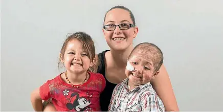  ?? PHOTO: SUPPLIED ?? Iziyah Moemai (right) has CGD and is going blind. He’s pictured with sister Kaylee and mum Dani Noyer.