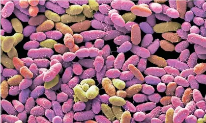  ?? Photograph: Steve Gschmeissn­er/ Getty Images/Science Photo Library RF ?? A faecal microbiota transplant helps an unhealthy gut to ‘repopulate the bacterial microenvir­onment’.