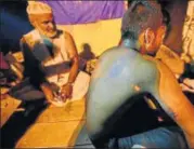  ?? VIPIN KUMAR/HT PHOTO ?? Shokin Ali (showing his injuries) was stopped and attacked by a mob of suspected cow vigilantes on Friday.