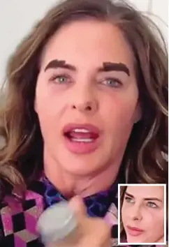  ??  ?? My one-liners: Trinny Woodall. Inset, after the procedure