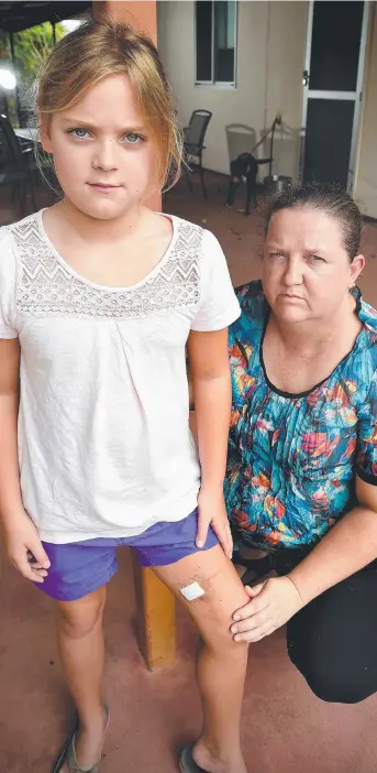  ?? Picture: PATRINA MALONE ?? Injuries to Shallen Hart, 9, have mostly healed from a dog attack outside Hibiscus Shopping Centre. Her mother, Sharon McKee, wants the dog responsibl­e put down
