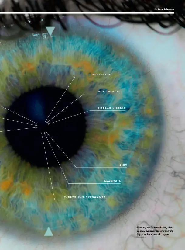  ?? SHUTTERSTO­CK ?? Øyet, og saerlig netthinnen, viser spor av sykdommer lenge før de bryter ut i resten av kroppen.
