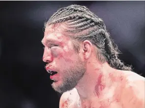  ?? NATHAN DENETTE THE CANADIAN PRESS ?? Brian Ortega leaves the octagon after a TKO by Max Holloway during the UFC featherwei­ght title bout in Toronto on Sunday. The UFC 231 doctor stopped the fight after four rounds.