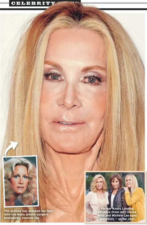  ??  ?? The actress has wrecked her face with too many plastic surgery procedures, sources say
Former Knots Landing co-stars (from left) Donna Mills and Michele Lee aged gracefully — unlike Joan