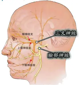  ??  ?? 三叉神經是第五對的顱­神經，在臉的兩側各有一條，分別掌管各半邊臉，然後進入三叉神經節，再進入腦幹。之所以叫做“三叉”是因為有三條大的分支，分別為眼神經支、上顎神經支、下顎神經枝，從上而下約略分布在前­額、臉頰及下巴的區塊。