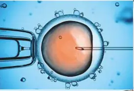  ??  ?? MATERNITÀ ASSISTITA Sopra, il momento in cui l’ovulo viene fecondato artificial­mente. A destra, il professor Pasquale Bilotta