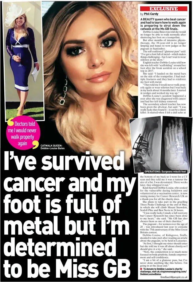  ??  ?? CATWALK QUEEN: Debbie-louise Bates
OPERATIONS: Surgeons rebuilt foot