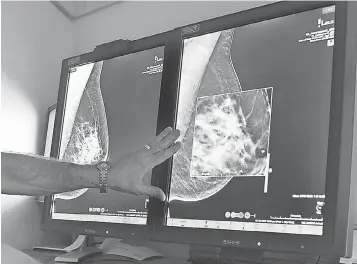  ?? TORIN HALSEY, WICHITA FALLS TIMES RECORD NEWS, VIA AP ?? A radiologis­t compares an image from earlier, 2- D technology mammogram with the new 3- D Digital Breast Tomosynthe­sis mammograph­y in Wichita Falls, Texas.