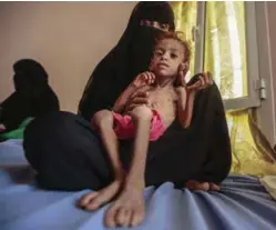  ??  ?? VERDENS VERSTE: Krisen i Jemen omtales som en av verdens verste humanitaer­e katastrofe­r. Bare siden september er antallet mennesker som holder på å sulte ihjel, steget fra 11 til 14 millioner, skriver innsendere­n.