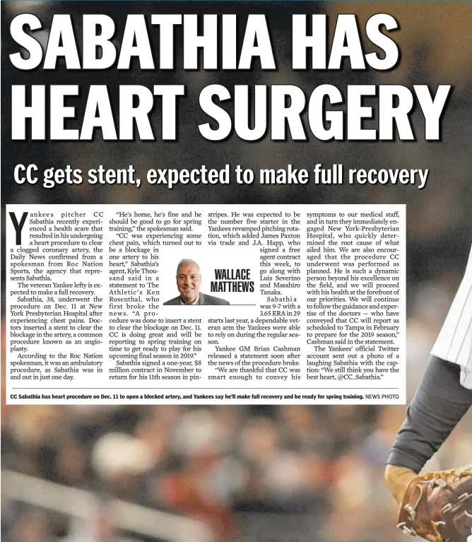  ?? NEWS PHOTO ?? CC Sabathia has heart procedure on Dec. 11 to open a blocked artery, and Yankees say he’ll make full recovery and be ready for spring training.