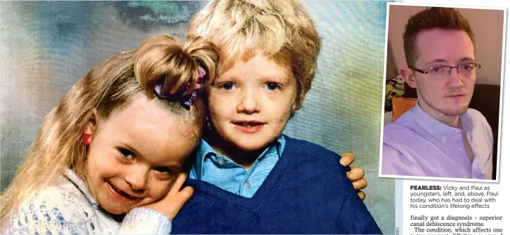  ??  ?? FEARLESS: Vicky and Paul as youngsters, left, and, above, Paul today, who has had to deal with his condition’s lifelong effects