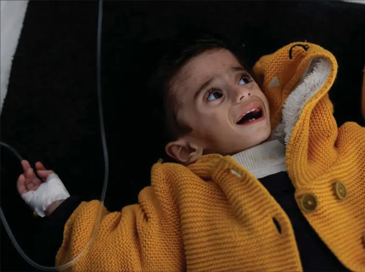  ?? ?? Ahmed Qannan har siden krigens start tabt halvdelen af sin kropsvaegt og vejer nu blot 6 kg. Han er et af et voksende antal børn i Gaza, der lider af underernae­ring. Foto: Mohammed Salem/Reuters