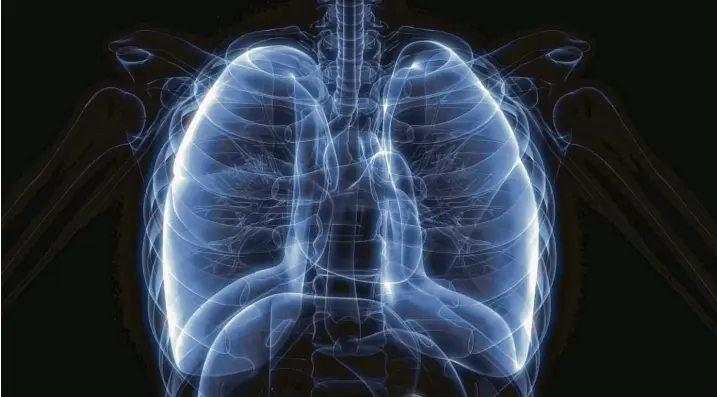  ?? Fotos: Getty Images, Veit, A. Tuszakowsk­i ?? Bei Mukoviszid­ose verstopft zäher Schleim die Lunge – hier ein Röntgenbil­d. Dank eines neuen Medikament­s können die Betroffene­n wieder freier atmen.