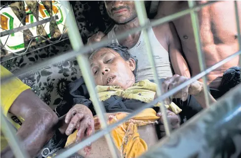  ?? AP ?? An injured elderly woman and her relatives rush to a hospital on an autoricksh­aw, near the border town of Kutupalong, Bangladesh, on Sept 4 after the Rohingya woman encountere­d a landmine that blew off the right leg while trying to cross into Bangladesh.