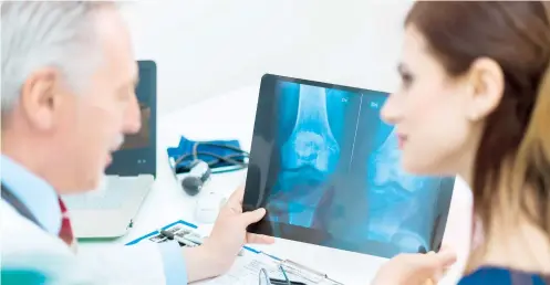  ??  ?? La osteoporos­is afecta a aproximada­mente una de cada tres mujeres y a uno de cada cinco hombres mayores de 50 años.