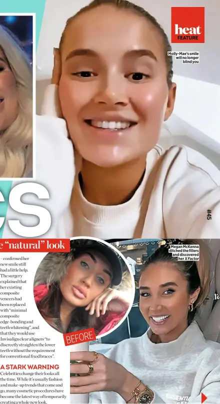  ??  ?? Molly-mae’s smile will no longer blind you
Megan Mckenna ditched the fillers and discovered her X Factor