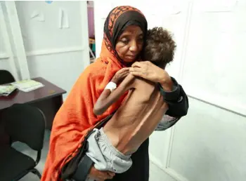  ??  ?? AN ALL-TOO PREVENTABL­E DISASTER: A woman carries her eight-year-old son, who is suffering from malnutriti­on in Yemen. Photo: Abdul Jabbar Zeyad/Reuters