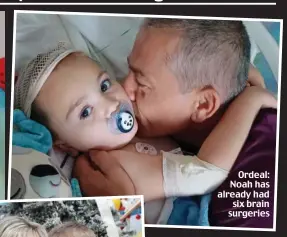  ?? ?? Ordeal: Noah has already had six brain surgeries