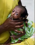  ?? — AFP ?? Struggling: A malnourish­ed newborn being attended to at the district hospital in Telangana state, India.