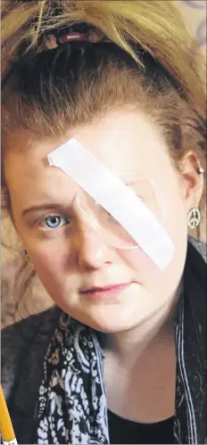  ?? Picture: Gary Browne FM3003816 ?? Kodie Cooper, 14. after being hit in the eye with a pencil thrown in class