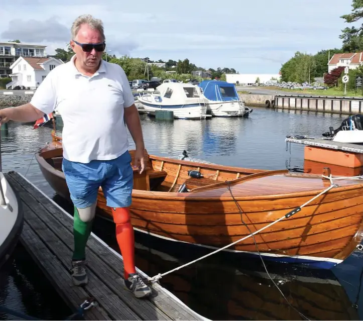  ?? ALLE FOTO: JANICKE YTTERVIK ?? VAREMERKE: De røde og grønne protesene er blitt varemerket til Nils-odd Tønnevold. Han valgte å gjøre noe gøy ut av protesene.