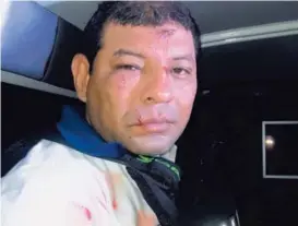  ?? MSP. ?? Pese al bombazo Oquendo no sufrió ninguna herida de gravedad.