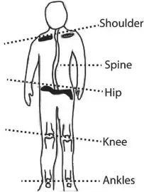  ??  ?? Misalignme­nt of body structure is not only an obstacle to beauty and health but also a major cause of neck and back pains.